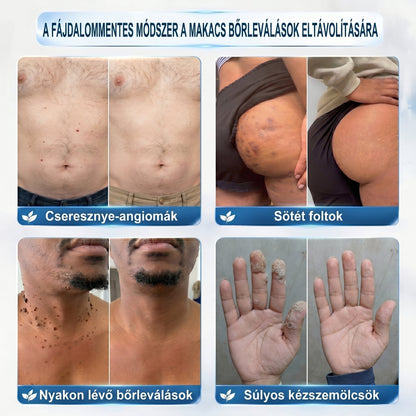 ✅🔱𝐇𝐢𝐯𝐚𝐭𝐚𝐥𝐨𝐬 𝐦á𝐫𝐤𝐚𝐛𝐨𝐥𝐭  𝐇𝐞𝐚𝐥𝐫𝐢𝐳𝐞®   𝟕 𝐍𝐚𝐩𝐨𝐬 𝐁ő𝐫𝐤𝐢𝐧ö𝐯é𝐬- é𝐬 𝐅𝐨𝐥𝐭𝐫𝐚𝐝í𝐫(Fájdalommentes, nyommentes roll-on)