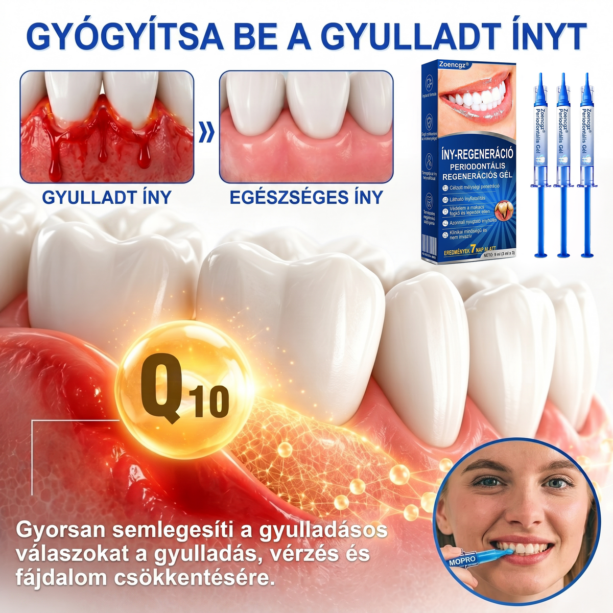 Zoencgz®🦷🔋 Antibakteriális ínyregeneráló gél | Látható eredmények már 7 nap alatt