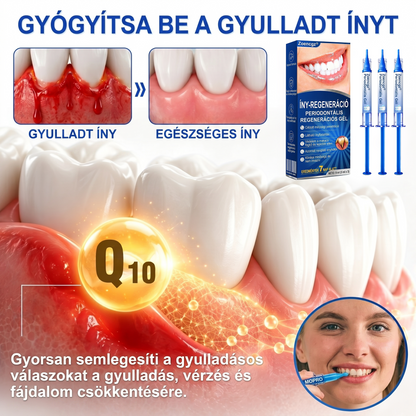 Zoencgz®🦷🔋 Antibakteriális ínyregeneráló gél | Látható eredmények már 7 nap alatt