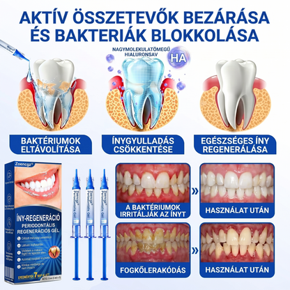 Zoencgz®🦷🔋 Antibakteriális ínyregeneráló gél | Látható eredmények már 7 nap alatt