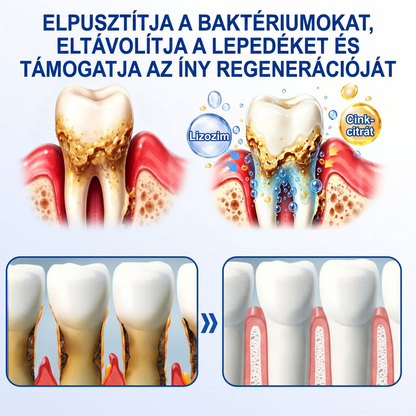 Zoencgz®🦷🔋 Antibakteriális ínyregeneráló gél | Látható eredmények már 7 nap alatt