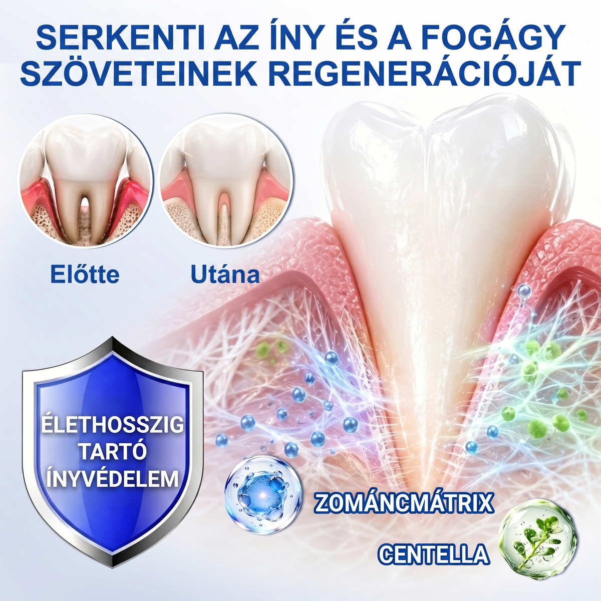 Zoencgz®🦷🔋 Antibakteriális ínyregeneráló gél | Látható eredmények már 7 nap alatt