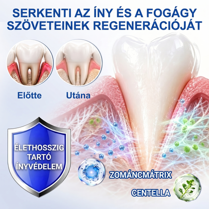 Zoencgz®🦷🔋 Antibakteriális ínyregeneráló gél | Látható eredmények már 7 nap alatt