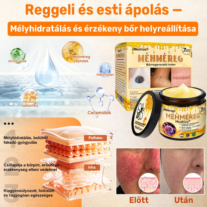 🐝💎 𝐇𝐞𝐚𝐥𝐫𝐢𝐳𝐞® Méhméreg Komplex Arckrém – A természetes bőrápolás új generációja hidratáltabb, simább és ragyogóbb bőrért 🌿✨