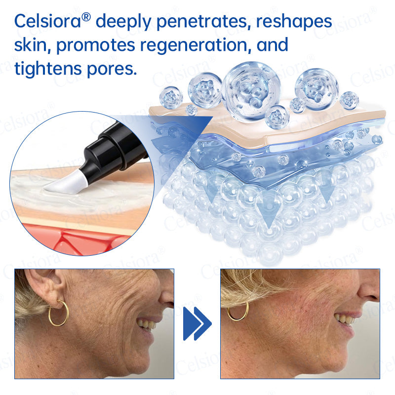 🌿🍀UK HOT SALE Celsiora® PDRN Anti-Wrinkle Shot – Lift & Firming Cream