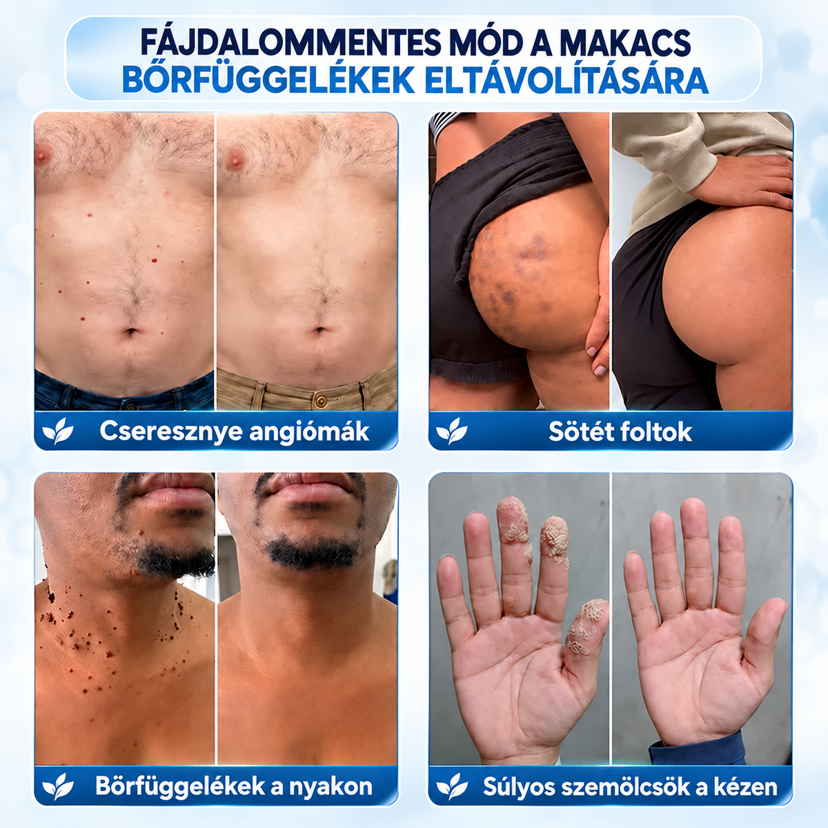 𝐇𝐞𝐚𝐥𝐫𝐢𝐳𝐞®🍄8️⃣ 7 napos krém bőrkinövések és pigmentfoltok ellen (fájdalommentes formula – hegmentes)🌿