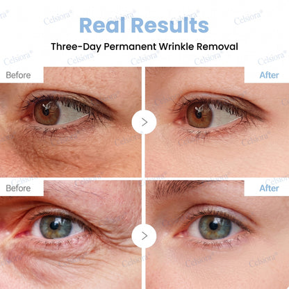 🌿🍀UK HOT SALE Celsiora® PDRN Anti-Wrinkle Shot – Lift & Firming Cream