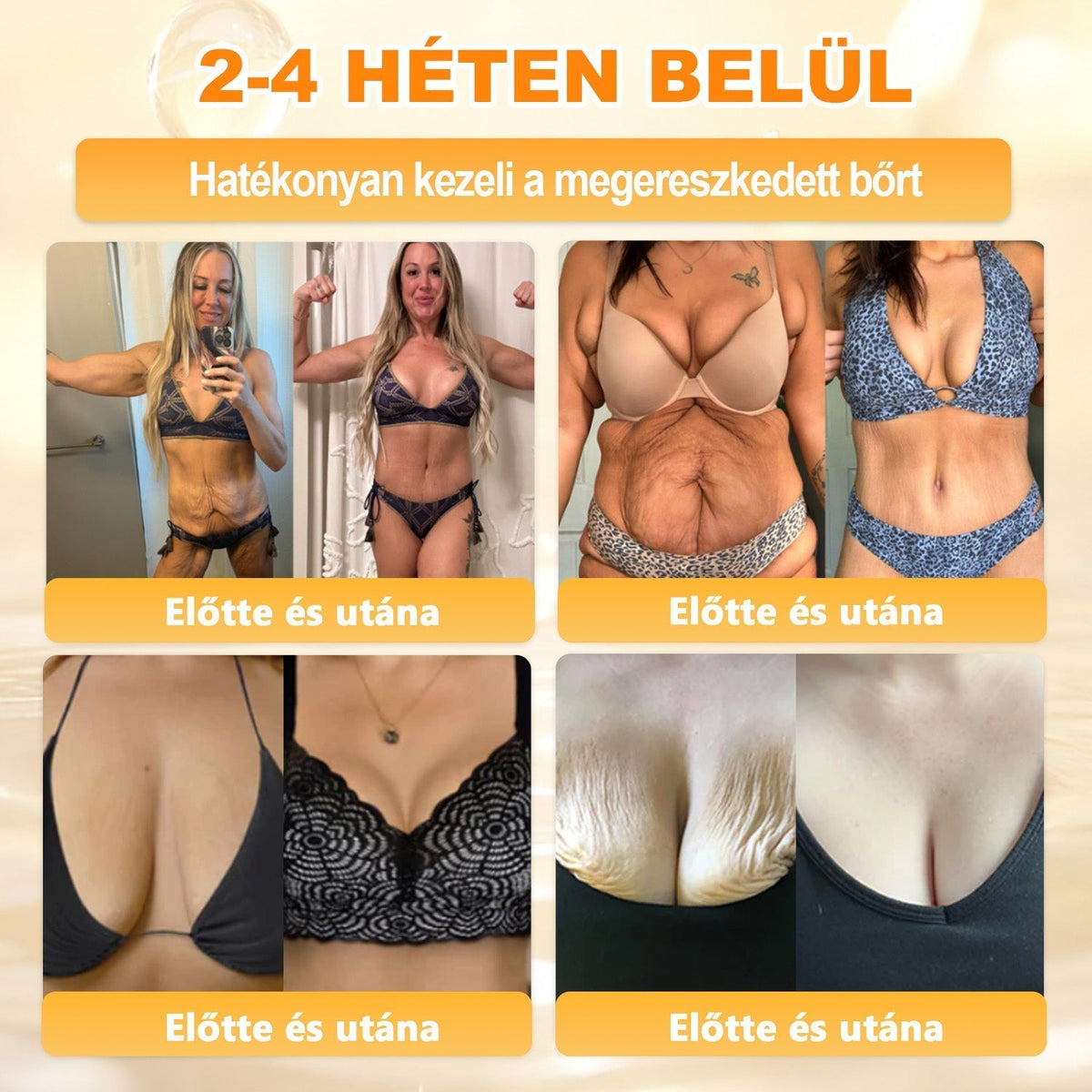 🐝💎 𝐇𝐞𝐚𝐥𝐫𝐢𝐳𝐞® Méhméreg Komplex Arckrém – A természetes bőrápolás új generációja hidratáltabb, simább és ragyogóbb bőrért 🌿✨