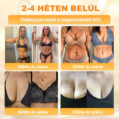 🐝💎 𝐇𝐞𝐚𝐥𝐫𝐢𝐳𝐞® Méhméreg Komplex Arckrém – A természetes bőrápolás új generációja hidratáltabb, simább és ragyogóbb bőrért 🌿✨