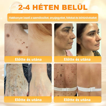 🐝💎 𝐇𝐞𝐚𝐥𝐫𝐢𝐳𝐞® Méhméreg Komplex Arckrém – A természetes bőrápolás új generációja hidratáltabb, simább és ragyogóbb bőrért 🌿✨