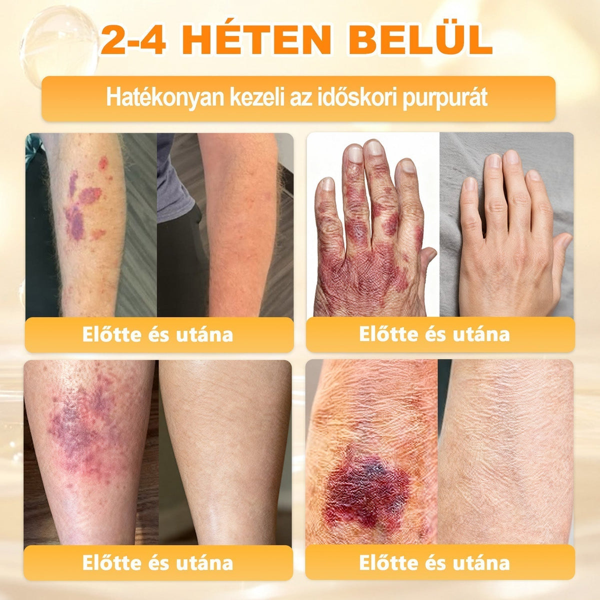 🐝💎 𝐇𝐞𝐚𝐥𝐫𝐢𝐳𝐞® Méhméreg Komplex Arckrém – A természetes bőrápolás új generációja hidratáltabb, simább és ragyogóbb bőrért 🌿✨