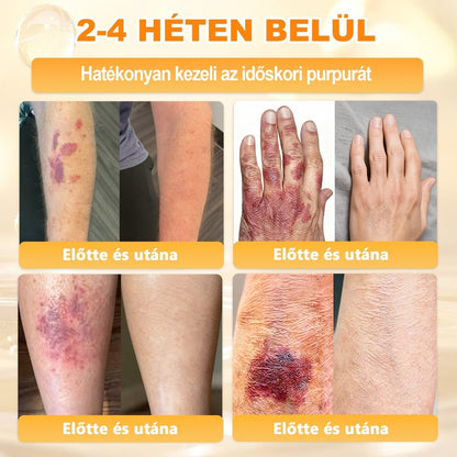 🐝💎 𝐇𝐞𝐚𝐥𝐫𝐢𝐳𝐞® Méhméreg Komplex Arckrém – A természetes bőrápolás új generációja hidratáltabb, simább és ragyogóbb bőrért 🌿✨