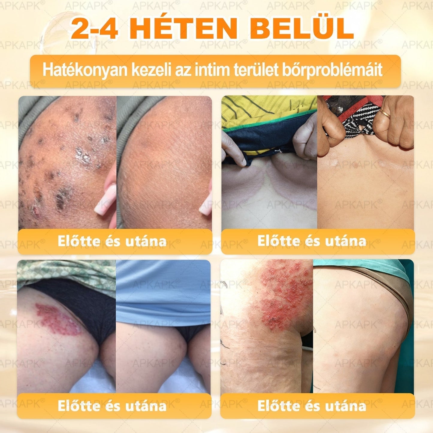 🐝💎 𝐇𝐞𝐚𝐥𝐫𝐢𝐳𝐞® Méhméreg Komplex Arckrém – A természetes bőrápolás új generációja hidratáltabb, simább és ragyogóbb bőrért 🌿✨
