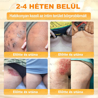 🐝💎 𝐇𝐞𝐚𝐥𝐫𝐢𝐳𝐞® Méhméreg Komplex Arckrém – A természetes bőrápolás új generációja hidratáltabb, simább és ragyogóbb bőrért 🌿✨