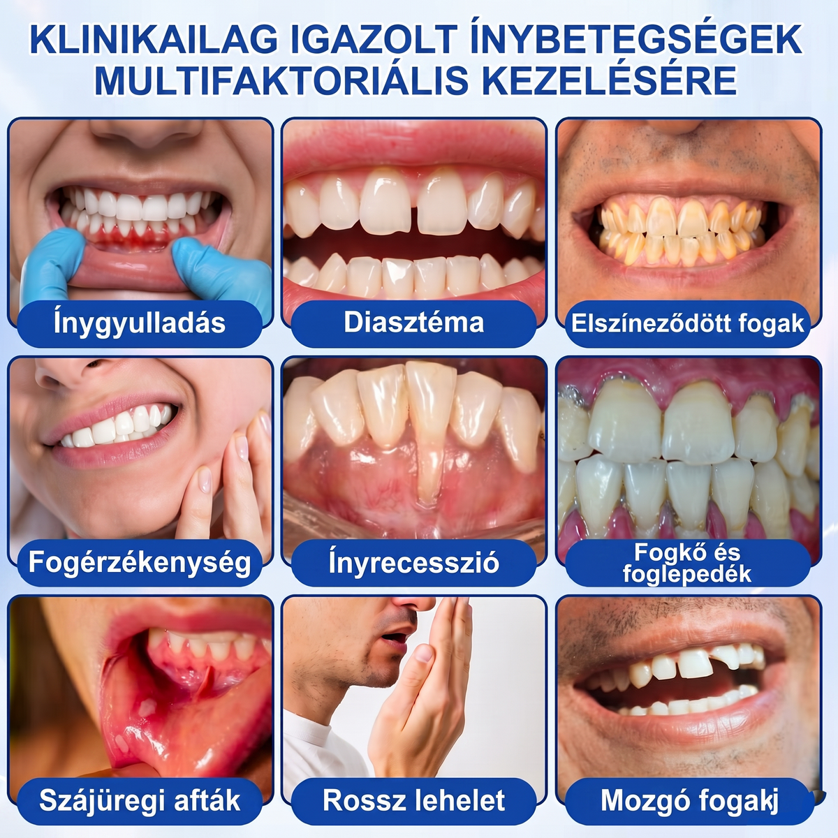 Zoencgz®🦷🔋 Antibakteriális ínyregeneráló gél | Látható eredmények már 7 nap alatt