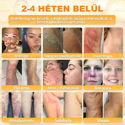 🐝💎 𝐇𝐞𝐚𝐥𝐫𝐢𝐳𝐞® Méhméreg Komplex Arckrém – A természetes bőrápolás új generációja hidratáltabb, simább és ragyogóbb bőrért 🌿✨