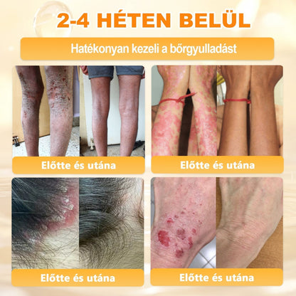 🐝💎 𝐇𝐞𝐚𝐥𝐫𝐢𝐳𝐞® Méhméreg Komplex Arckrém – A természetes bőrápolás új generációja hidratáltabb, simább és ragyogóbb bőrért 🌿✨