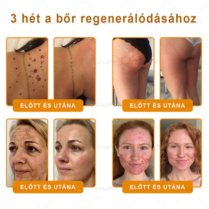 🐝💎 𝐇𝐞𝐚𝐥𝐫𝐢𝐳𝐞® Méhméreg Komplex Arckrém – A természetes bőrápolás új generációja hidratáltabb, simább és ragyogóbb bőrért 🌿✨