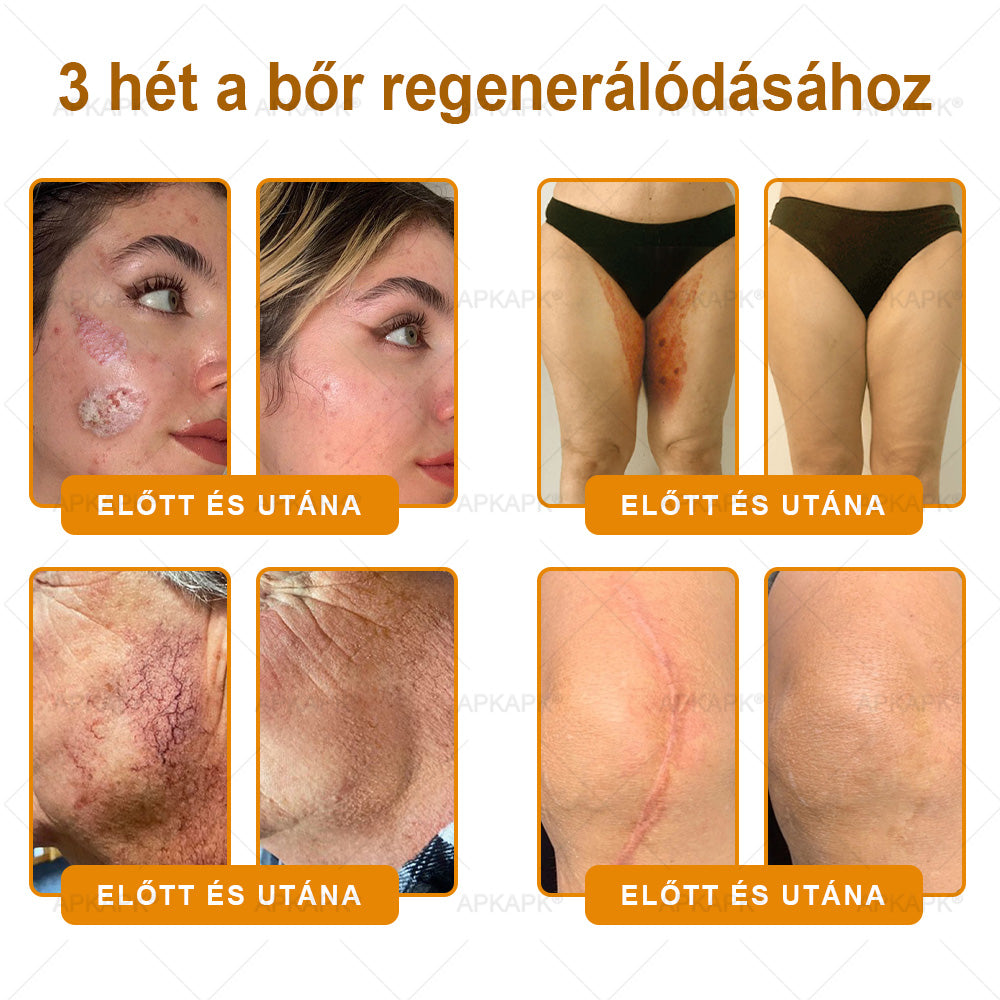🐝💎 𝐇𝐞𝐚𝐥𝐫𝐢𝐳𝐞® Méhméreg Komplex Arckrém – A természetes bőrápolás új generációja hidratáltabb, simább és ragyogóbb bőrért 🌿✨