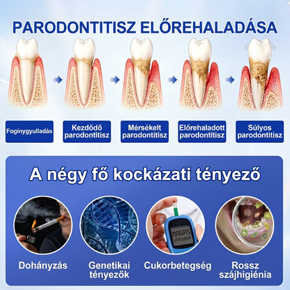 Zoencgz®🦷🔋 Antibakteriális ínyregeneráló gél | Látható eredmények már 7 nap alatt